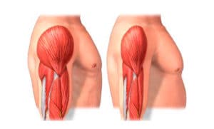 Lee más sobre el artículo ¿Qué enfermedades causan pérdida de masa muscular?